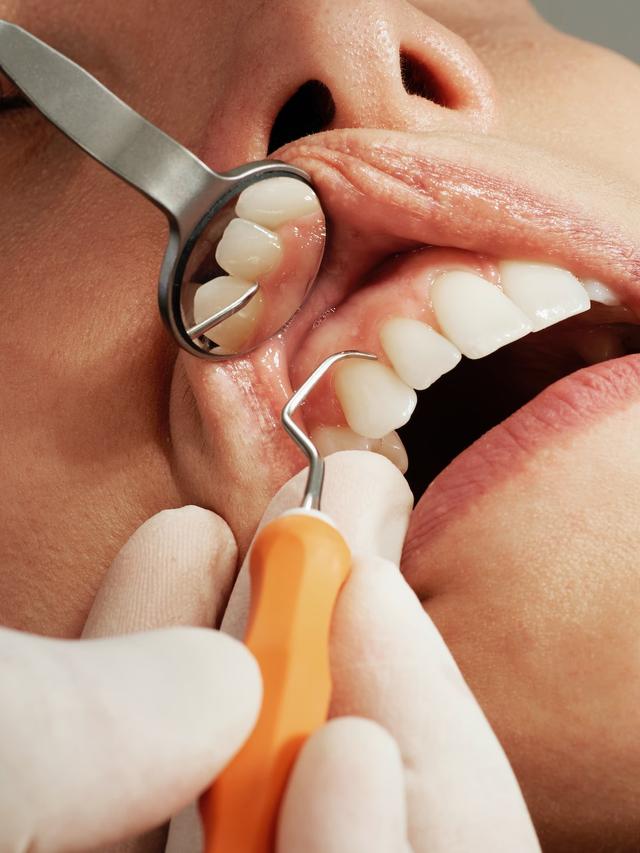 Recognizing Dental Disease